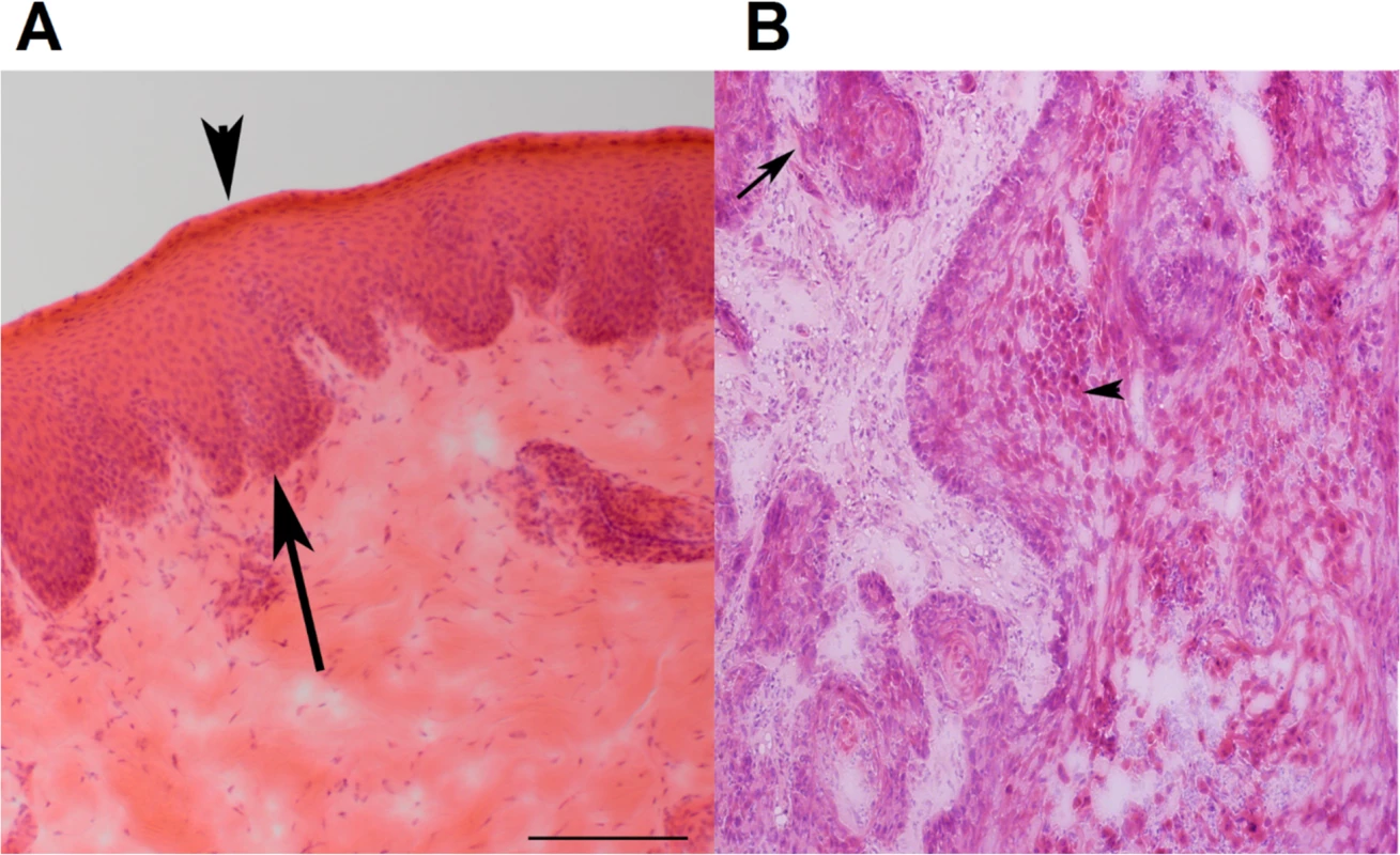 Representative H&amp;E stained images of canine normal squamous epithelium and SCC of the oral cavity.