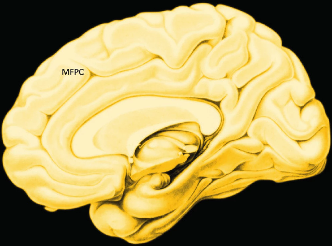 Empatie: oblasti mozku aktivované experimentální zátěží na přesnost empatického
rozlišování. Těžiště i aktivita systému empatie se mění podle typu zátěže (46)
MFG – střední čelní závit, PMC – premotorická kůra, IPL – lobulus parietalis inferior,
STS – sulcus temporalis superior, RPFC – přední prefrontální kůra,
MPFC – vnitřní prefrontální kůra