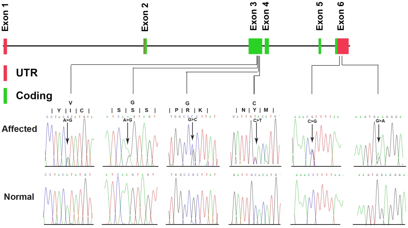 Genomic structure of the exons encoding the open reading frame of <i>ZNF644</i> and identified mutations.
