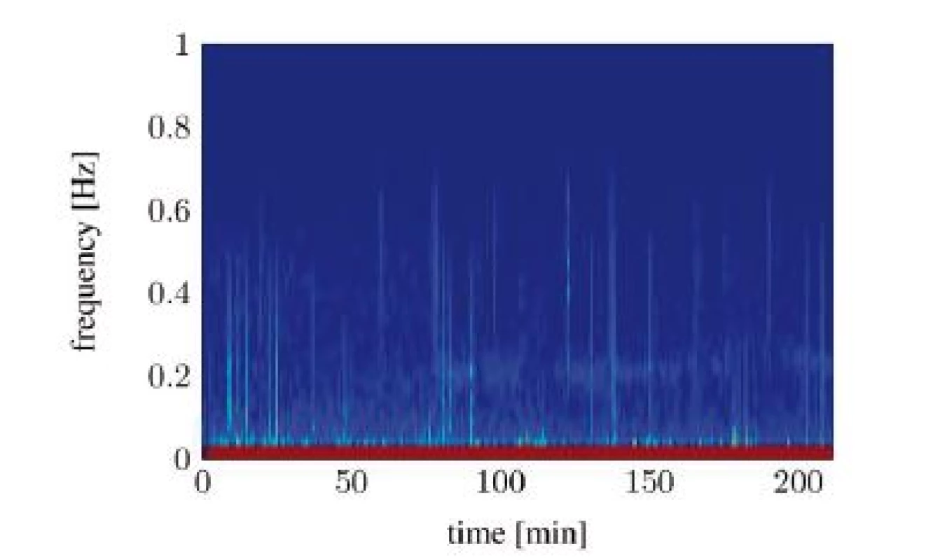 Spectral signal representation of the heart rate variability through the short time Fourier transform (pat02): no RSA detectable.