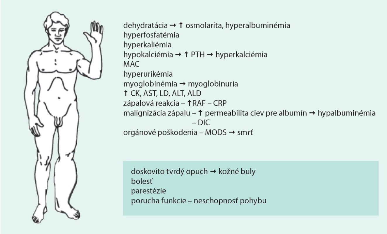 Lokálne príznaky a biochemický obraz pacienta s ASKS
