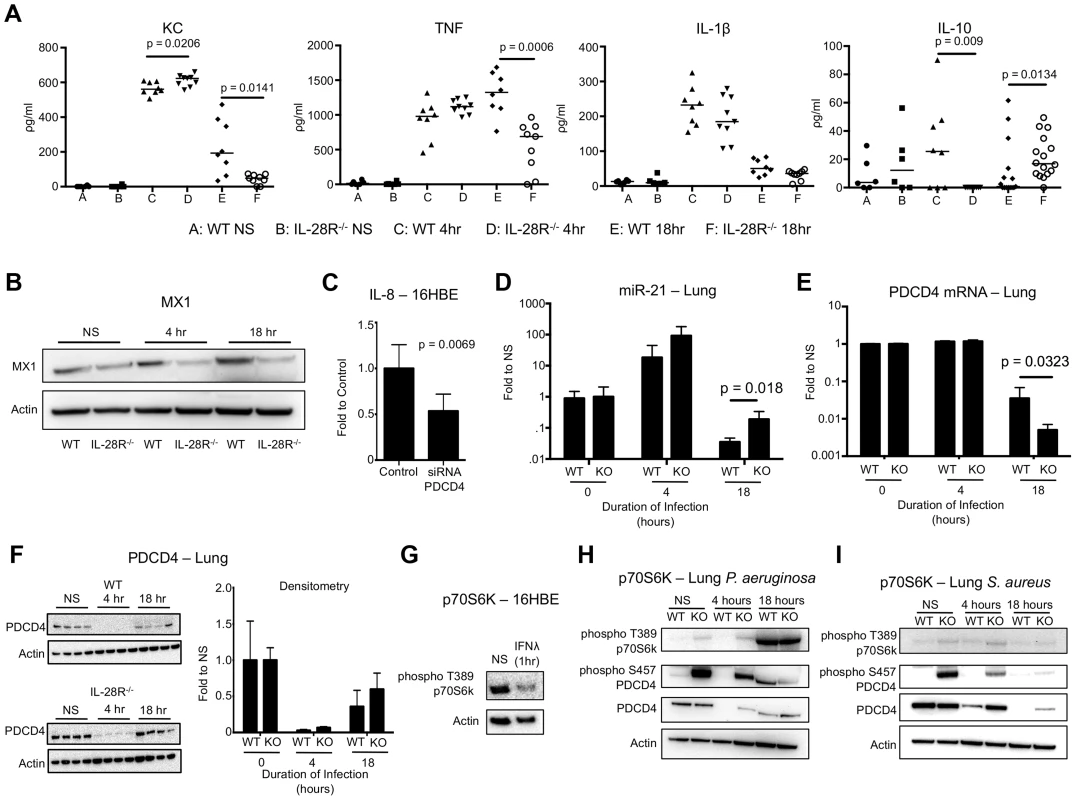 <i>P. aeruginosa</i> induced cytokine, miR-21, and PDCD4 expression in WT and IL-28R<sup>−/−</sup> mice.