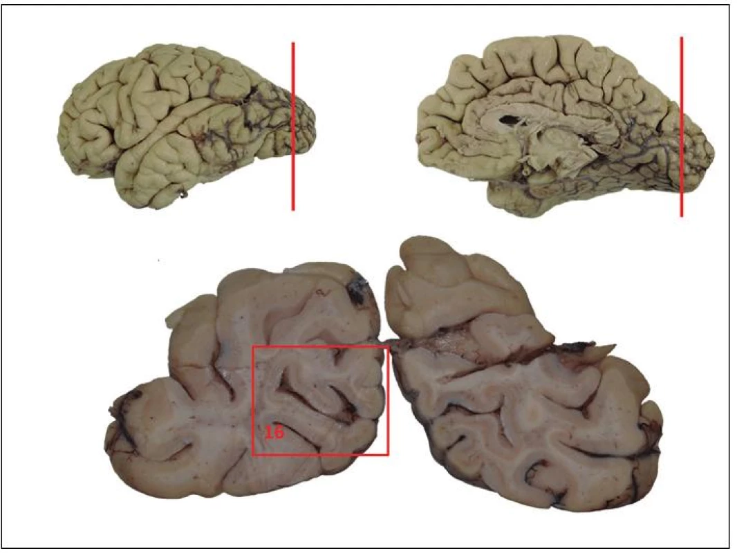 Schéma základního odběru při pitvě mozku.
