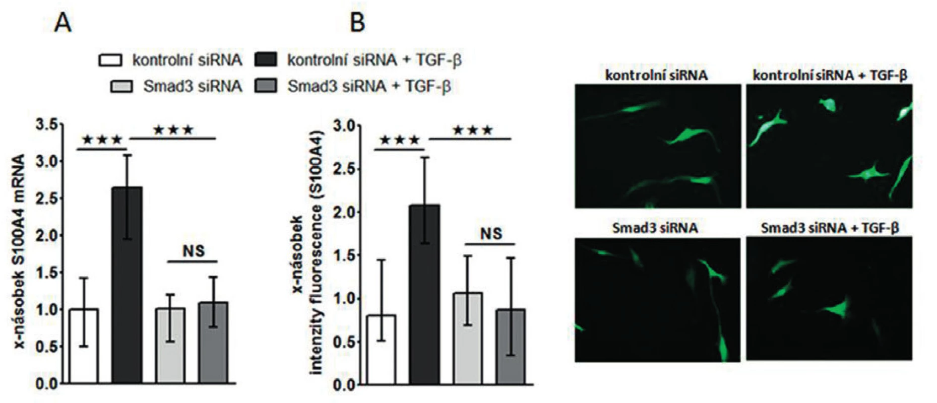 Exprese S100A4 je indukovaná ve zdravých fibroblastech pomocí TGF-ß v závislosti na Smad3.
