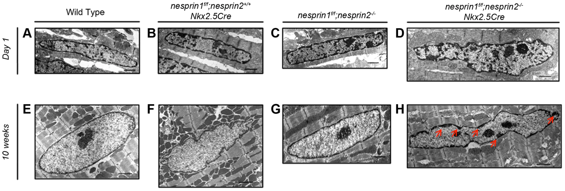 Examination of cardiomyocyte nuclear ultrastructure in response to loss of Nesprin 1 and/or 2.