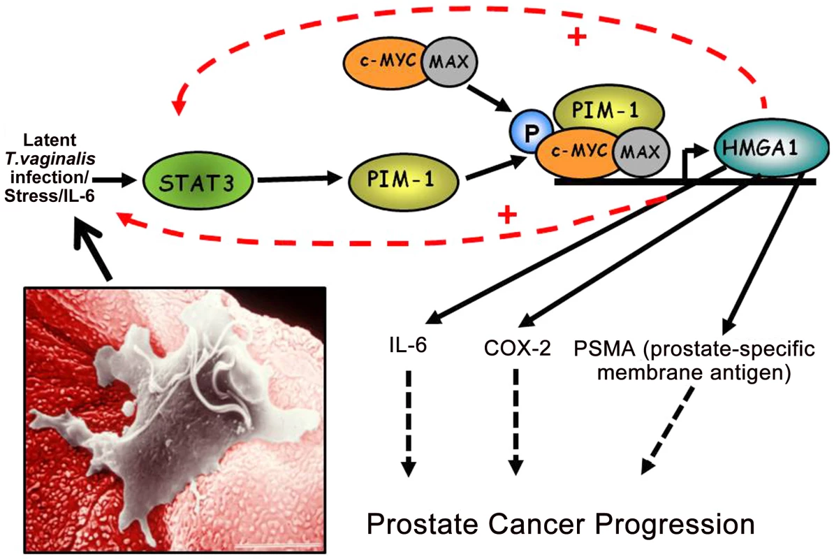A working model of how chronic, latent <i>T. vaginalis</i> infection of prostate tissue up-regulates the signaling cascade leading to prostate carcinogenesis.