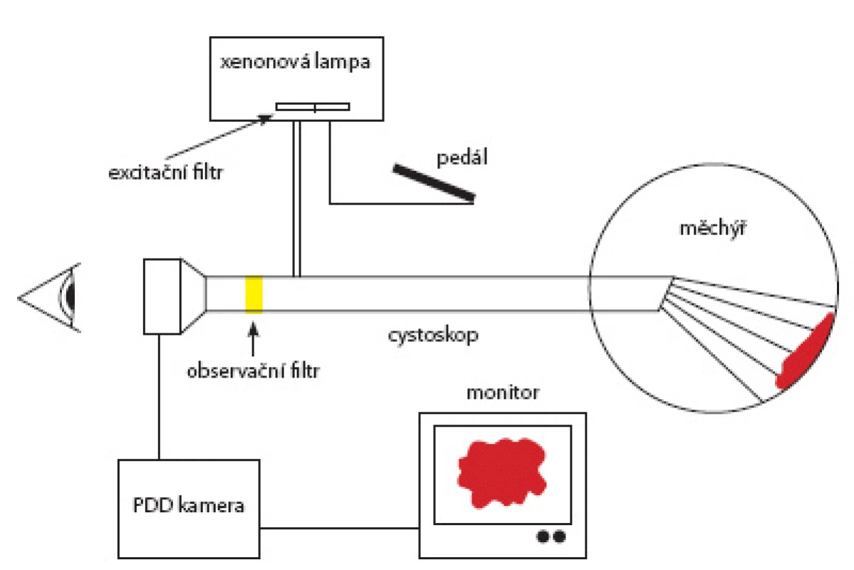 Princip zapojení fluorescenční cystoskopie
Fig. 1. Principle of fluorescent cystoscopy set up