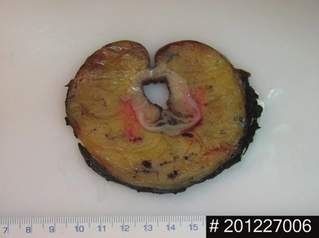 Příklad obsažené fotodokumentace – resekát, příčná lamela
Fig. 5: Example of image documentation – cross-section of the the biopsy cut
