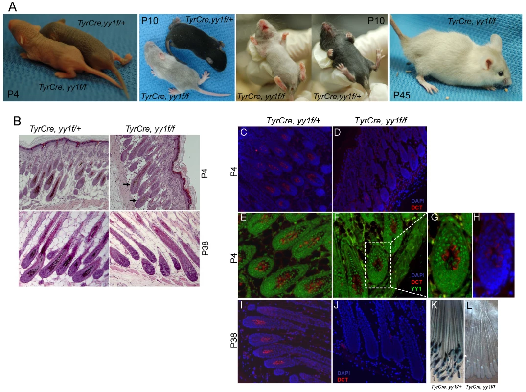 YY1 is required for melanocyte development in vivo.