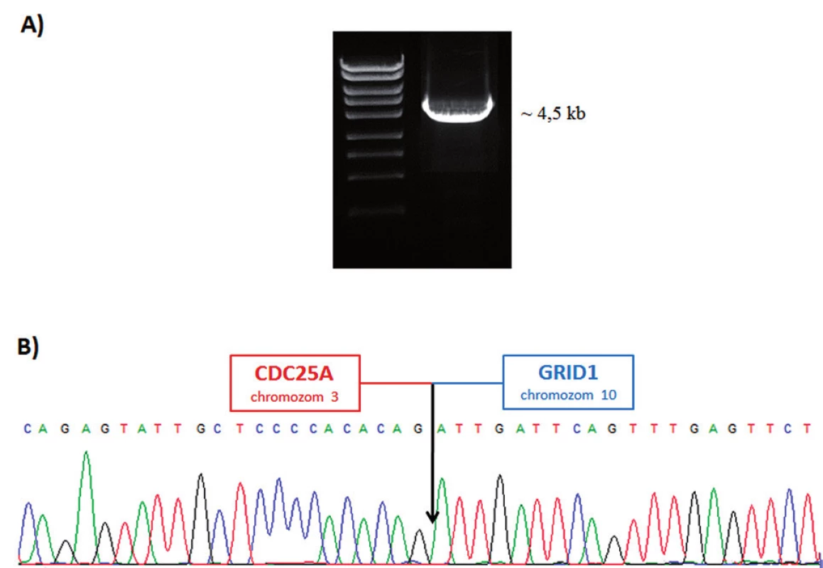 Buněčná linie K562. A) LR-PCR produkt. B) Nukleotidová sekvence zlomu derivovaného chromozomu 10.