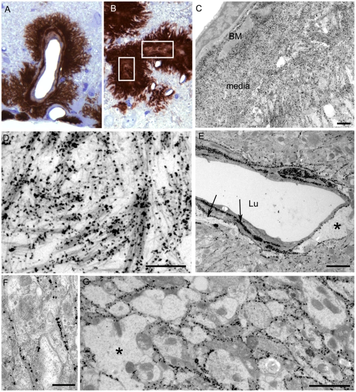 Immunological detection of PrPres in brain at both light and electron microscopic levels.