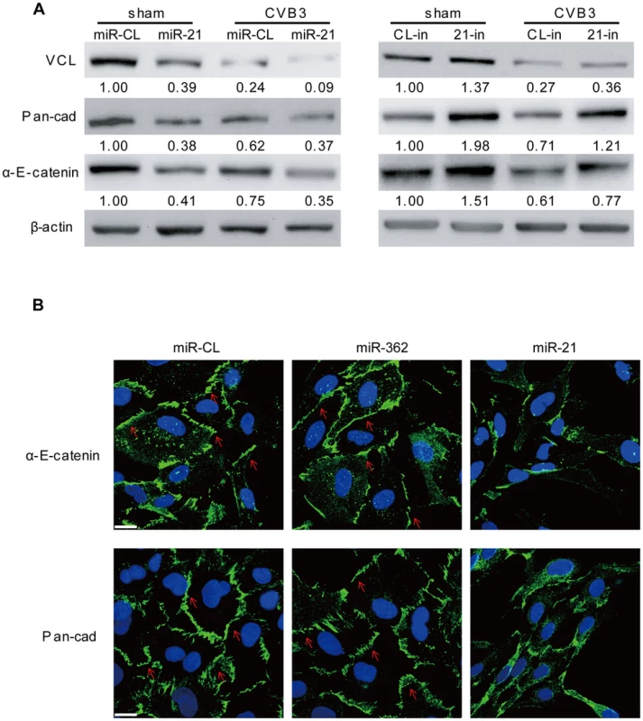 miR-21 interrupts fascia adherens during CVB3 infection.