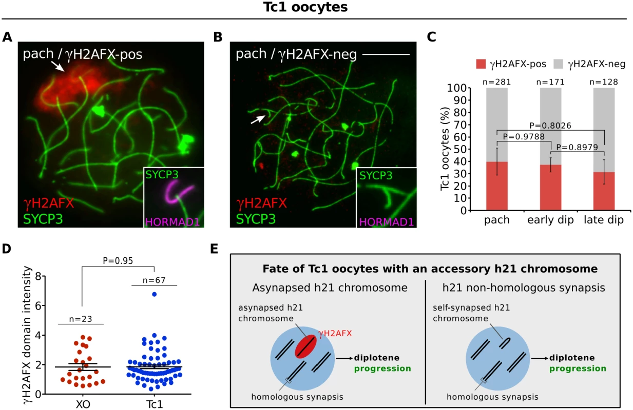Oocytes in the Tc1 accessory chromosome mouse model do not exhibit diplotene elimination.