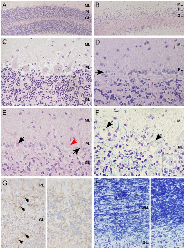 Histological findings within the cerebellar cortex of affected dogs.