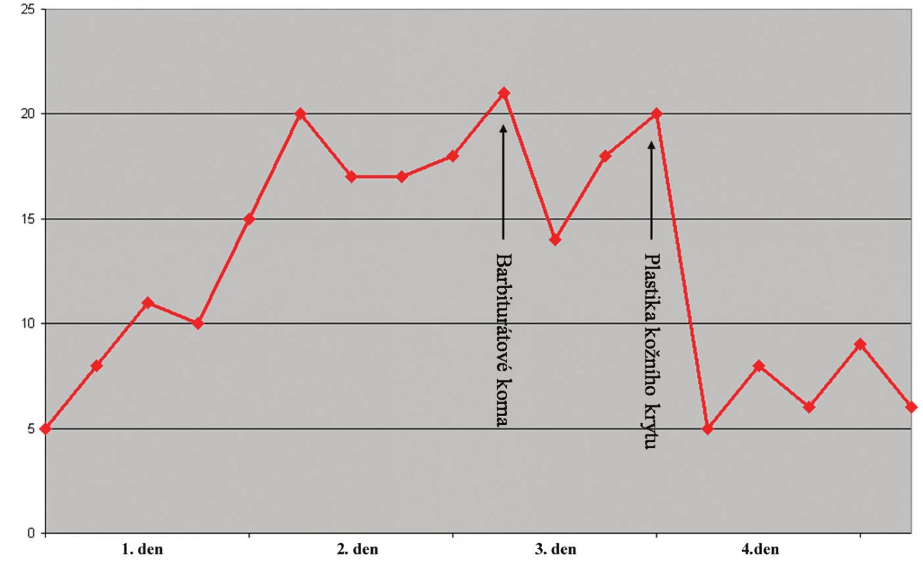 Graf se záznamem hodnot nitrolebního tlaku. Hodnoty tlaku jsou v mm Hg
Fig. 4. Graph of the recorded intracranial pressure values in mm Hg