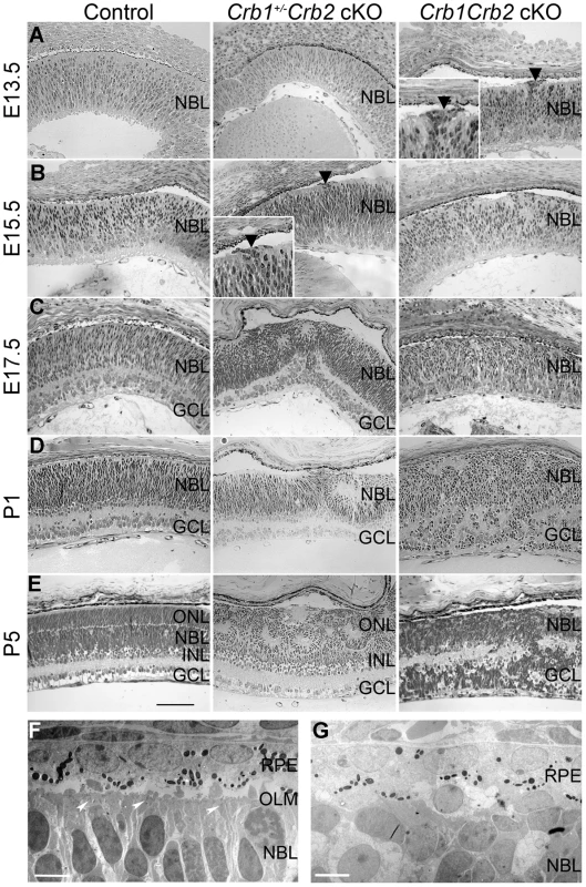 Retinal development is impaired in <i>Crb1Crb2</i> cKO.