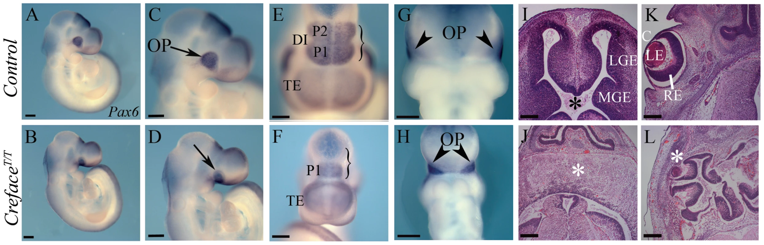 <i>Creface<sup>T/T</sup></i> embryos exhibit brain anomalies.