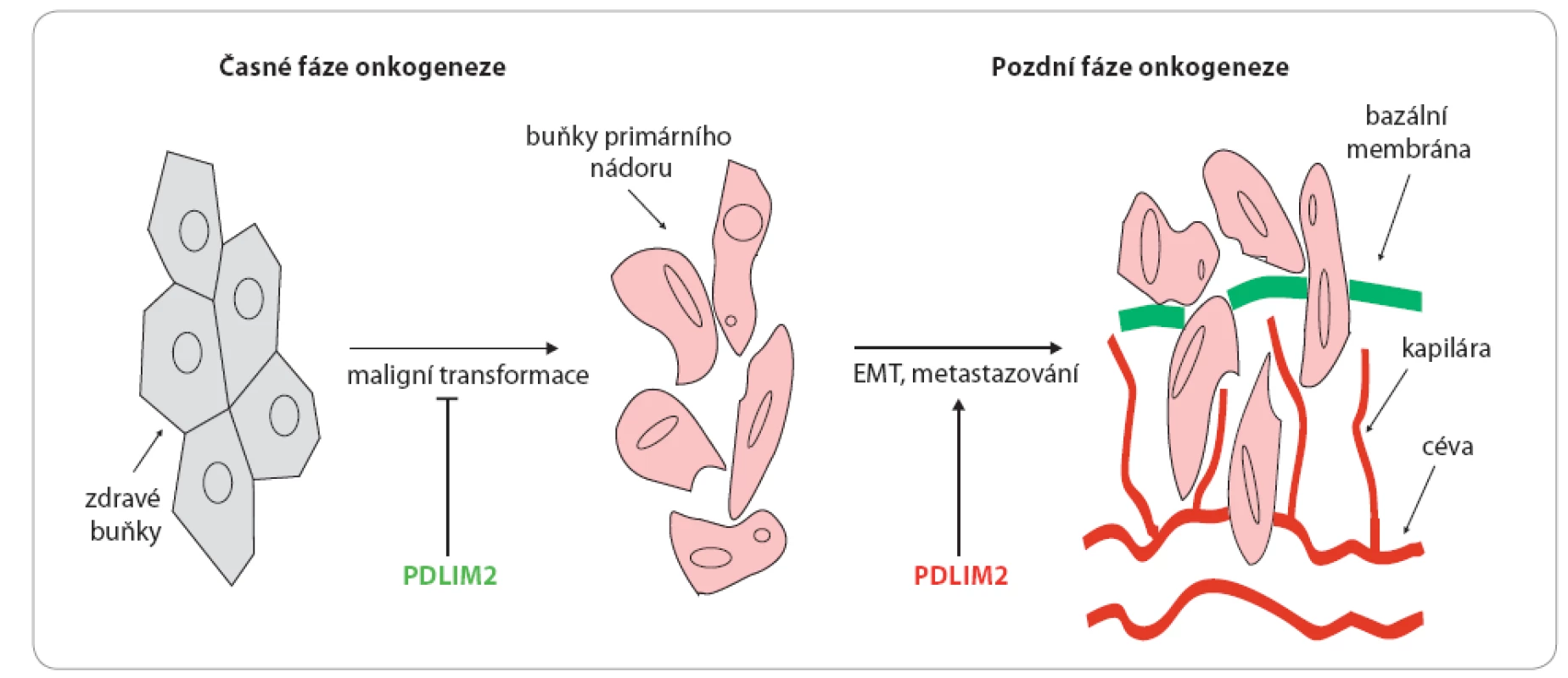 Duální role PDLIM2 v onkogenezi.