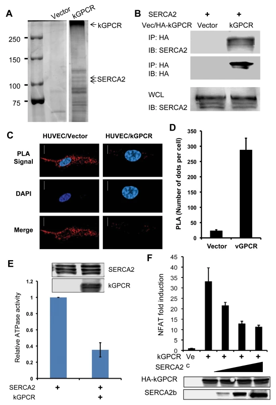 kGPCR interacts with SERCA2 and inhibits its ATPase activity.