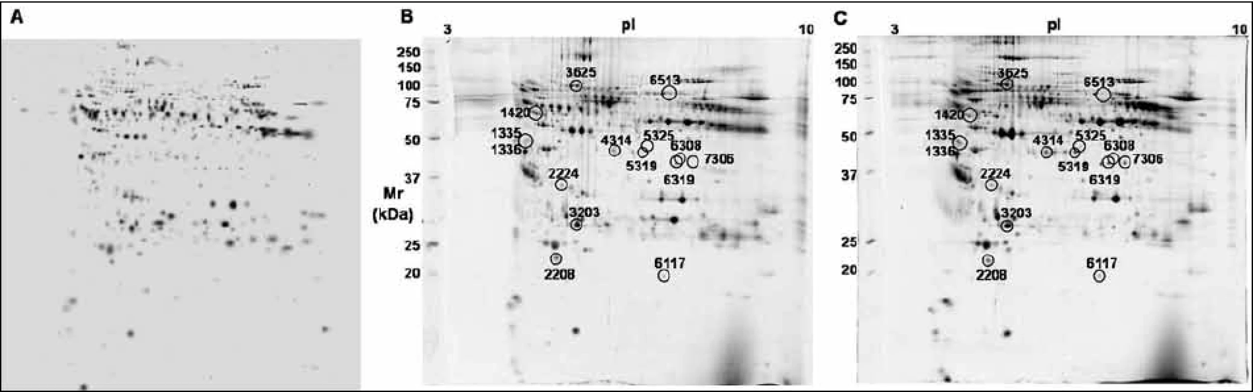 Ukázky záznamu 2-DE analýzy proteinů od pacientů nemocných mnohočetným myelomem po frakcionaci krevní plazmy metodou ProteoMiner. (A) Syntetický obraz 2-DE tzv. Master gel normalizovaných dat všech 36 2-DE gelů. (B) Reprezentativní 2-DE gel proteinů krevní plazmy pacienta citlivého na léčbu bortezomibem. (C) Reprezentativní 2-DE gel proteinů krevní plazmy pacienta rezistentního na léčbu bortezomibem.