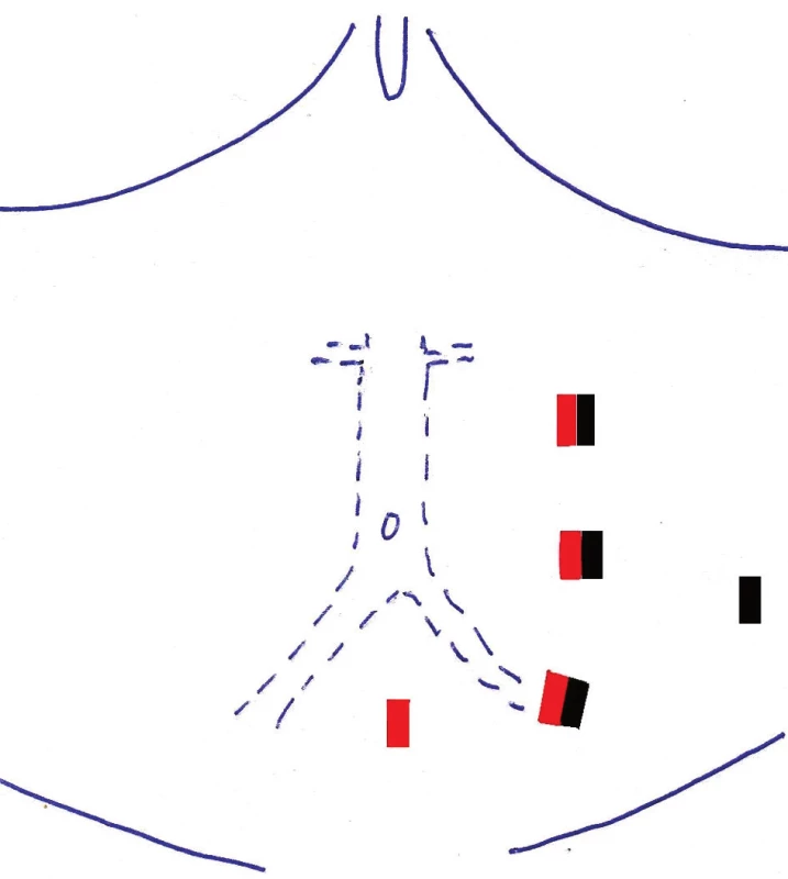 Schéma portů
červeně – pravostranný IF bypass
černě – levostranný IF bypass