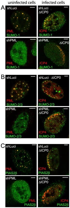 Recruitment of SUMO family members and PIAS2β to HSV-1 induced foci.