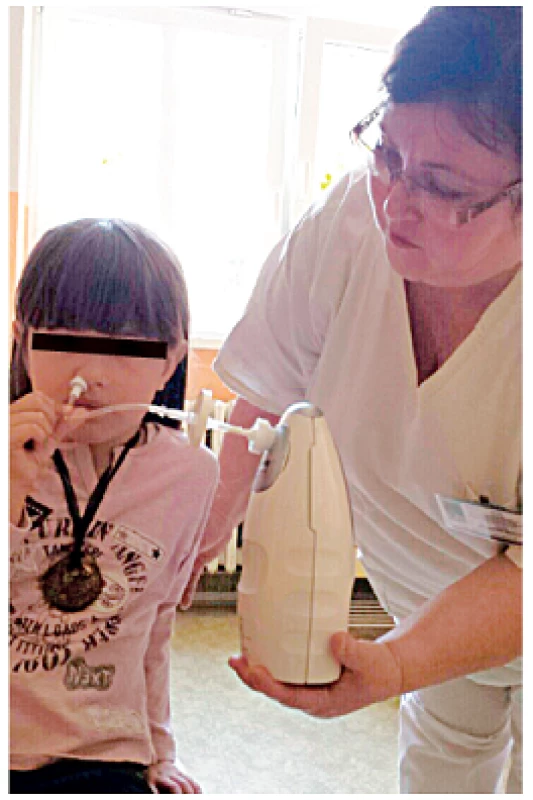 Stanovovanie koncentrácie oxidu dusnatého z nosovej dutiny u dieťaťa.
Fig. 2. Measurement of nasal nitric oxide concentration.