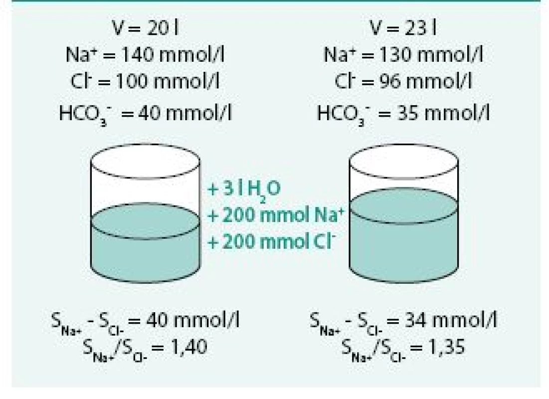 Model retence vody a sodíku (diluční hyponatremie hypervolemická)