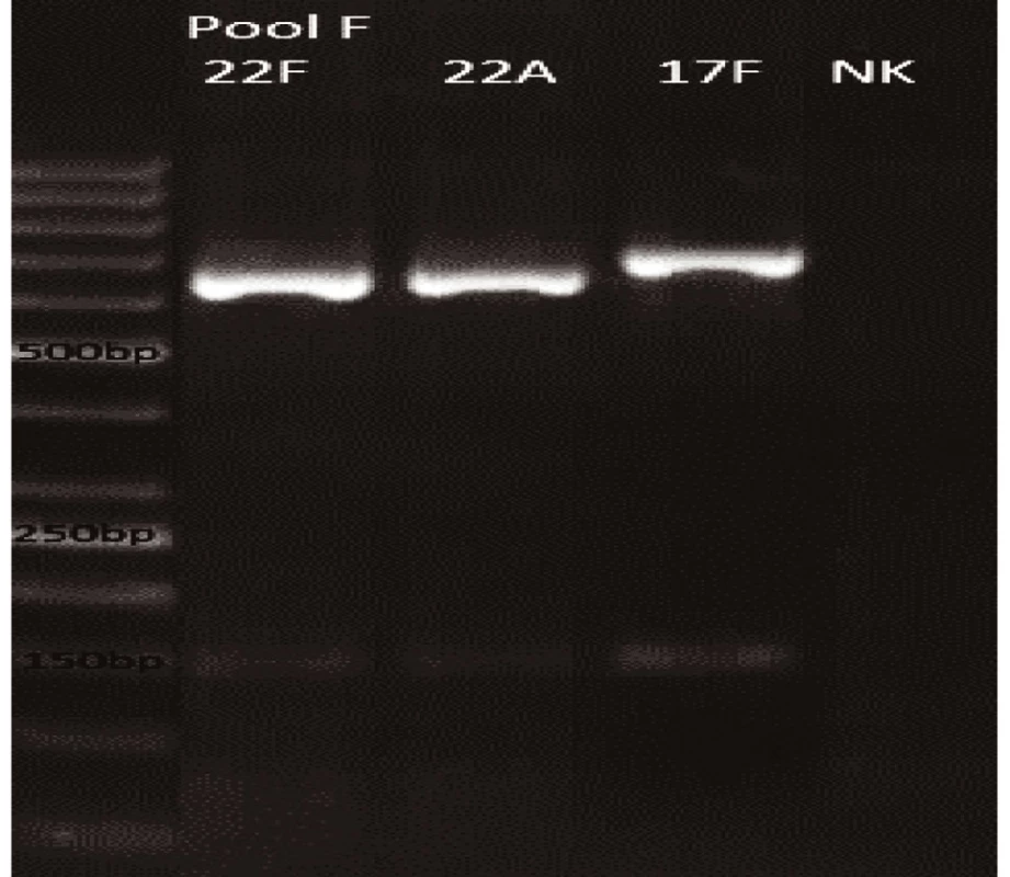 mPCR pool F
Dráha 1: 50bp DNA Ladder
Dráha 2: &lt;i&gt;S. pneumoniae&lt;/i&gt; sérotyp 22F (643bp)
Dráha 3: &lt;i&gt;S. pneumoniae&lt;/i&gt; sérotyp 22A (643bp)
Dráha 4: &lt;i&gt;S. pneumoniae&lt;/i&gt; sérotyp 17F (693bp)
Dráha 5: negativní kontrola
Dráha 2–4: pozitivní produkt cpsA (160bp)&lt;br&gt;
Fig. 6. mPCR pool F
LLane 1: 50bp DNA Ladder
Lane 2: &lt;i&gt;S. pneumoniae&lt;/i&gt; serotype 22F (643bp)
Lane 3: &lt;i&gt;S. pneumoniae&lt;/i&gt; serotype 22A (643bp)
Lane 4: &lt;i&gt;S. pneumoniae&lt;/i&gt; serotype 17F (693bp)
Lane 5: negative control
Lanes 2–4: positive product cpsA (160bp)