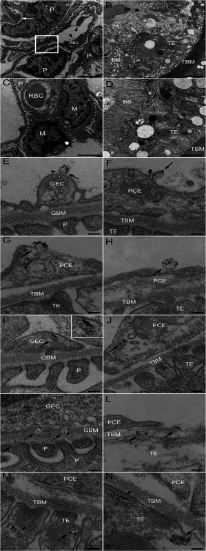 Ultramorphology of the renal cortex in mice infected with <i>E. coli</i> O157:H7.