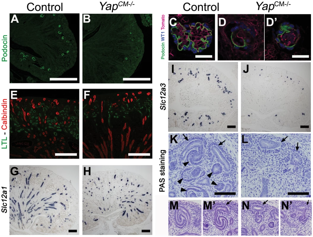 Loss of CM-derived epithelial structures and abnormal morphogenesis in <i>Yap</i> mutants.