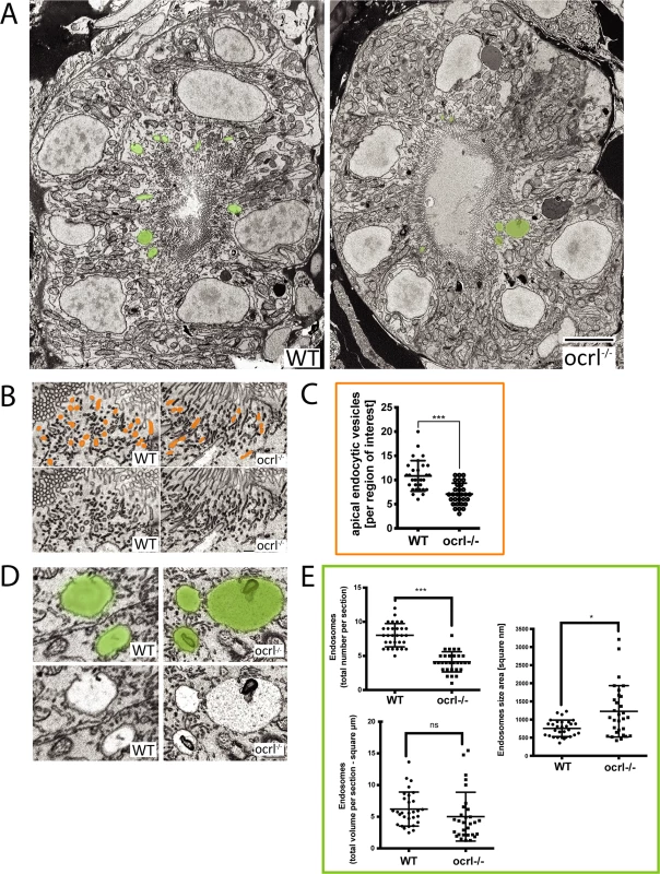 Electron microscopy analysis of endocytic compartments in OCRL1 deficient pronephros.