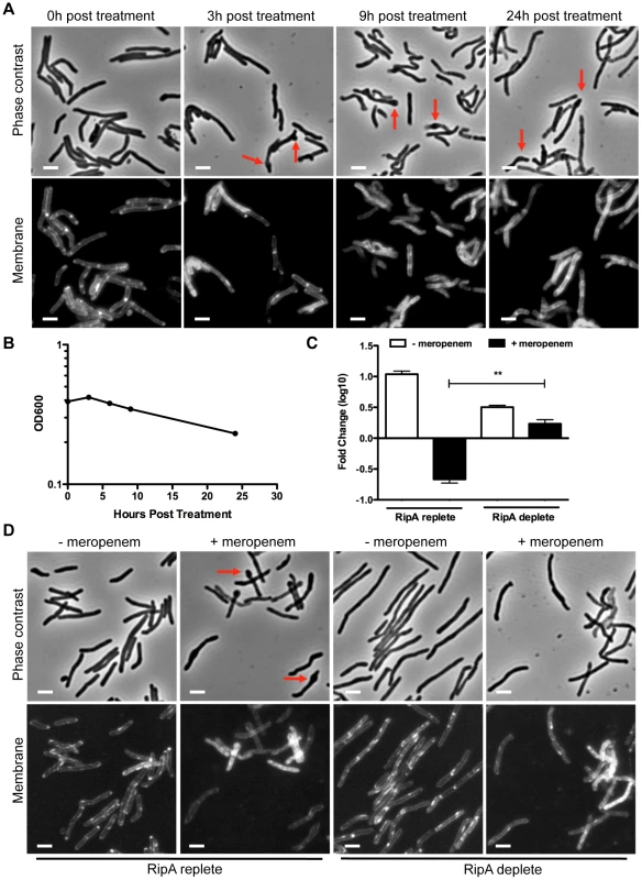 RipA depletion protects cells from meropenem-induced lysis.