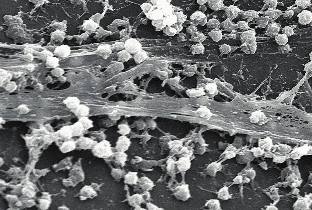 &lt;em&gt;Staphylococcus aureus&lt;/em&gt; a biofilm na povrchu centrálního žilního katetru (převzato z Wikipedie).
Fig. 1. &lt;em&gt;Staphylococcus aureus&lt;/em&gt; and the biofilm on the surface of central venous catheter.