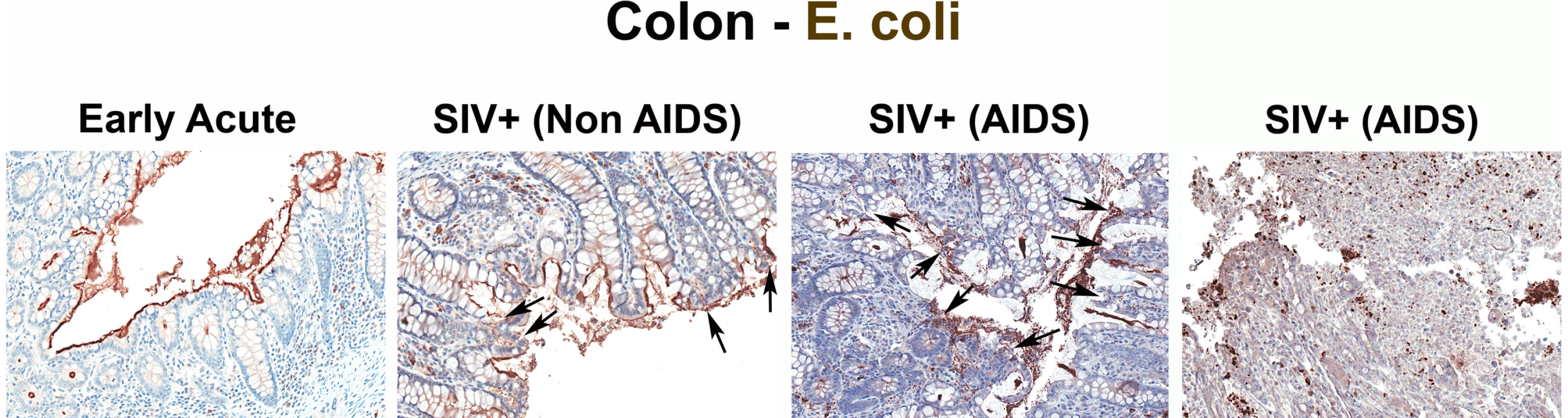 Identification of microbial translocation in large bowel of chronically SIV<sup>+</sup> RMs.
