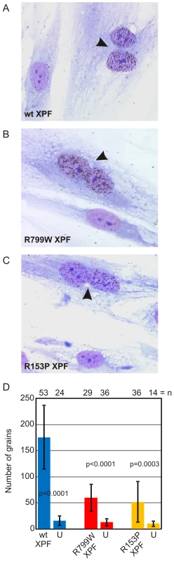 Correction of <i>XPF</i> mutant cell NER defect by microinjection of XPF-ERCC1.