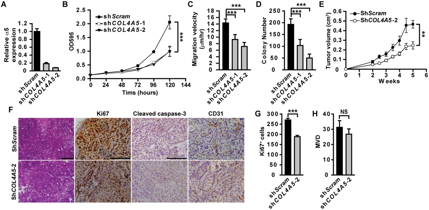 Epithelial α5(IV) supports tumor cell growth and tumorigenicity.