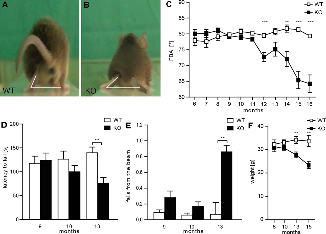 Disruption of Spatacsin in mice results in a severe spastic and ataxic gait disorder.