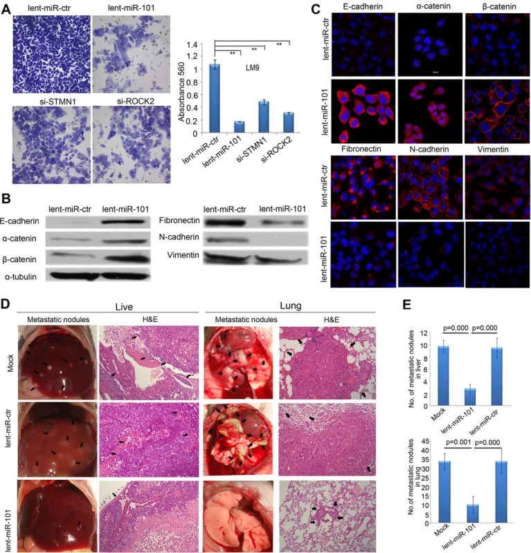 Enforced overexpression of miR-101 inhibits HCC LM9 cells invasion and EMT <i>in vitro</i> and reduces metastasis <i>in vivo</i>.