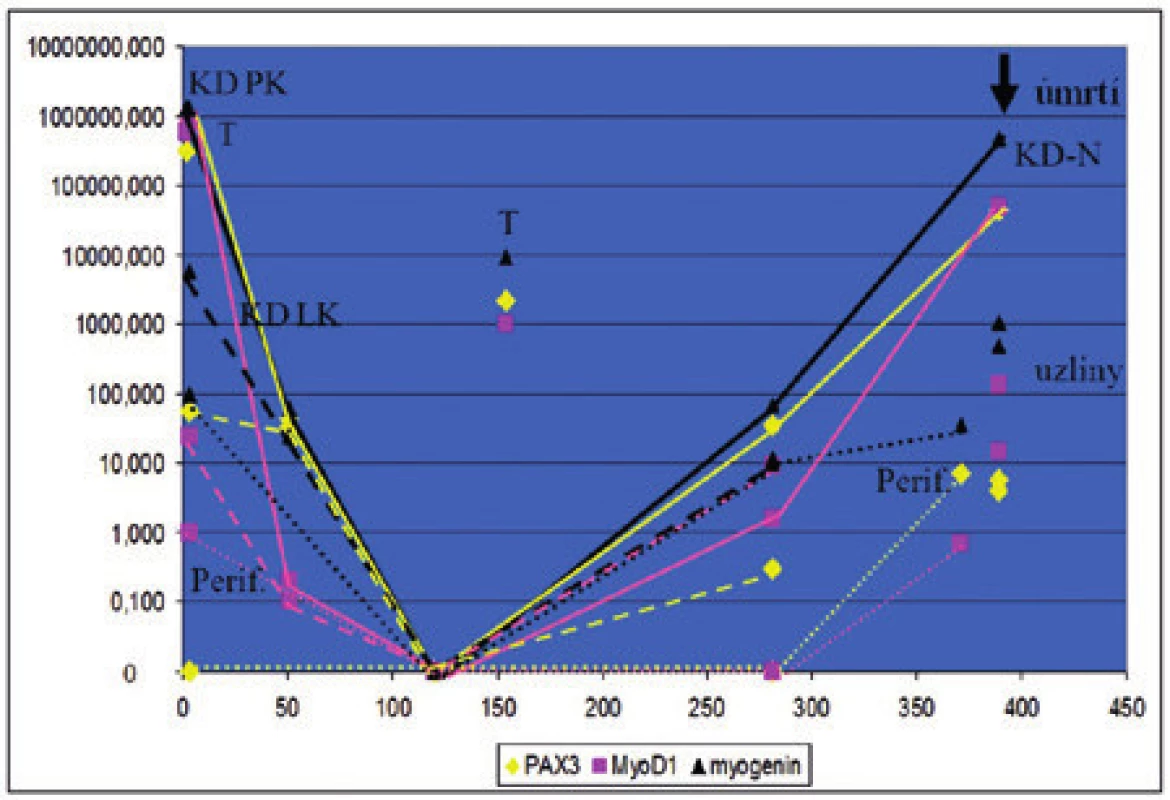 Sledování dynamiky MDN pomocí monitorování exprese fúzního genu PAX3/FOXO1 a transkripčního faktoru MyoD1 u pacientky s alveolárním rabdomyosarkomem. Pacientka měla v době diagnózy masivní infiltraci kostní dřeně rabdomyoblasty. Hodnoty na levé vertikální ose představují hladinu exprese PAX3/FOXO1 a MyoD1, na horizontální ose je znázorněná doba od diagnózy. KD – aspirát kostní dřeně, KD P – aspirát z pravé lopaty kyčelní, KD L – aspirát z levé lopaty kyčelní, Perif. – periferní krev, T – nádorová tkáň, uzliny – lymfatické uzliny při odběru z nekropsie.
