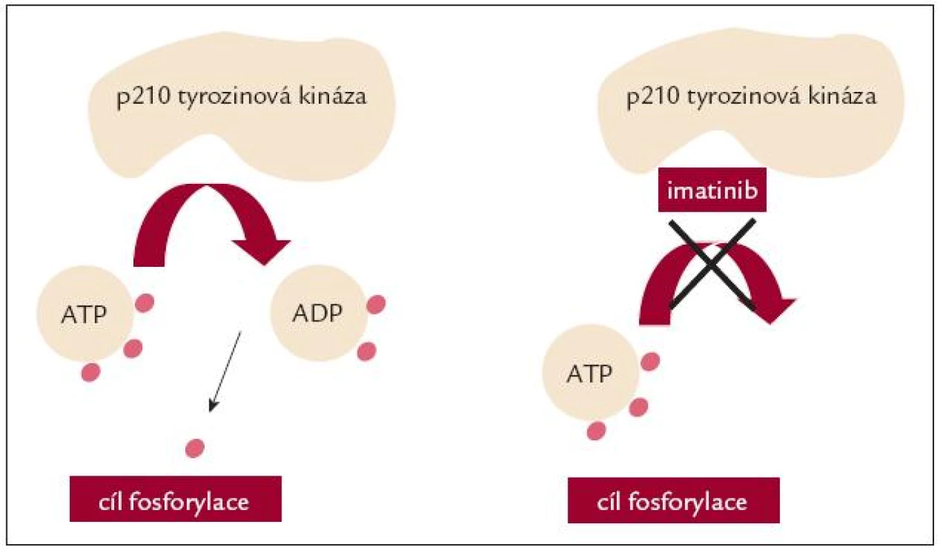 Imatinib blokuje vazbu ATP k abl tyrozinové kináze.