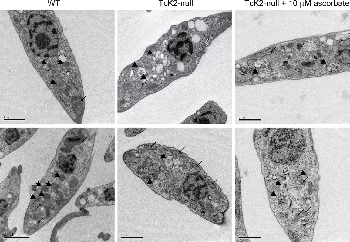 TcK2 null parasites lose electron dense organelles and their contents are not restored by ascorbate.