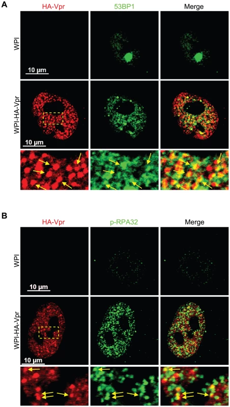 Vpr nuclear foci co-localizes partially with DNA repair foci.