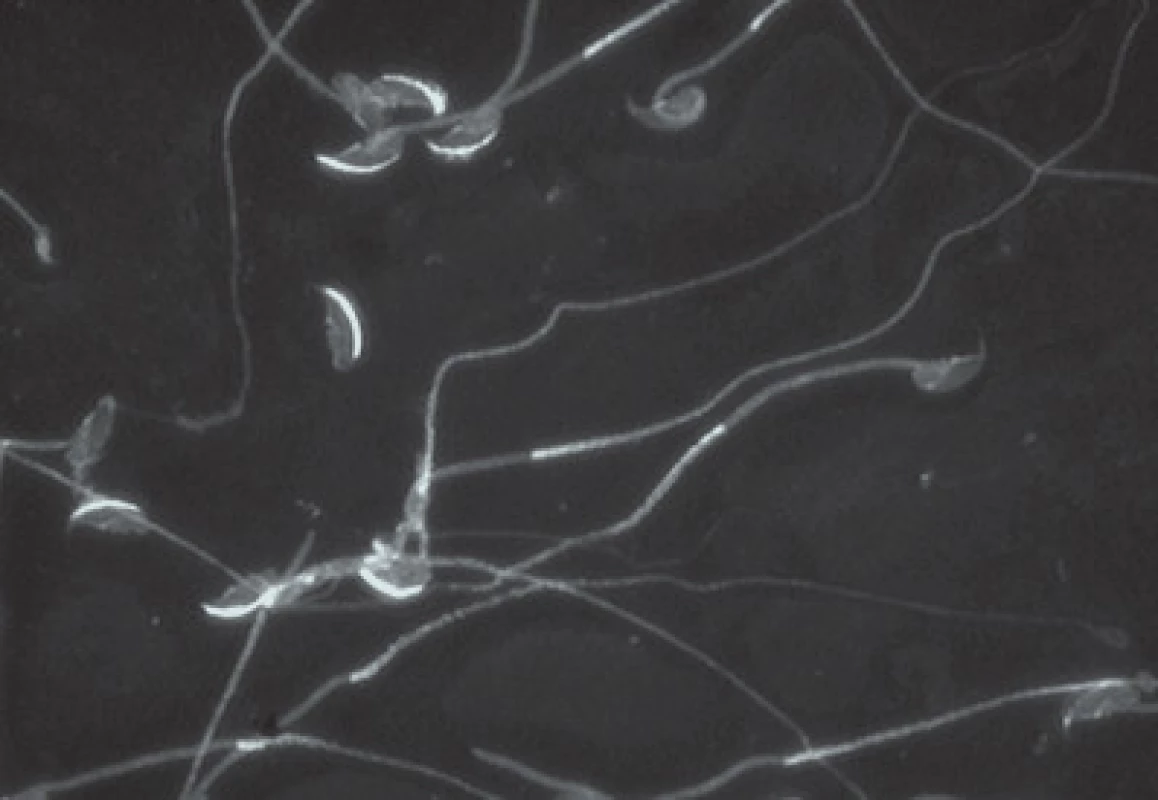 Imunofluorescenční značení akrosomu myších spermií pomocí monoklonální protilátky (Hs-14) proti akrozomálním proteinům, kontrolní skupina a experimentální po ovlivnění bisfenolem A.