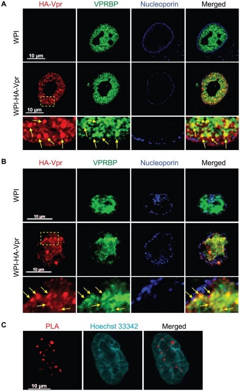 HIV-1 Vpr forms nuclear foci containing VPRBP.
