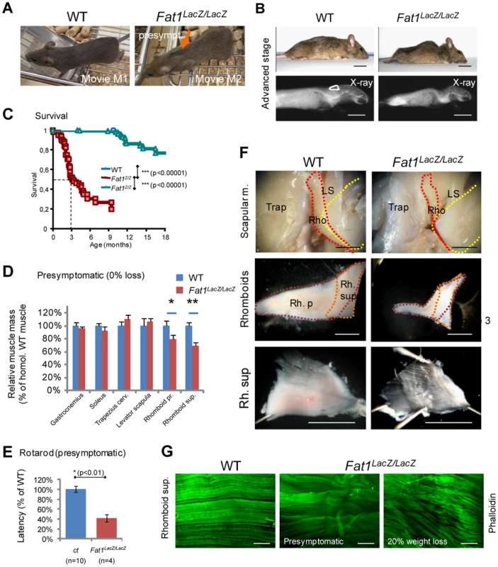 Presymptomatic adult <i>Fat1</i> mutant mice show selective defects in scapular muscles.