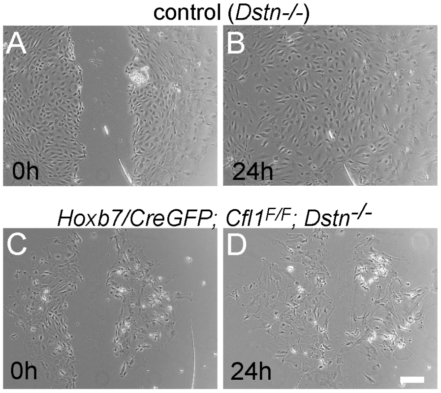 Migration assay for primary ureteric bud cells reveals defects in epithelial cell movement in <i>Cfl1;Dstn</i> double mutant.