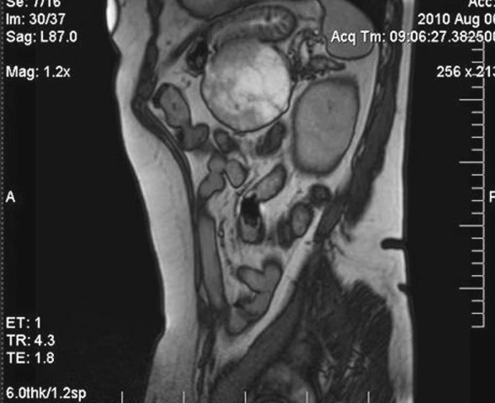 MRI vyšetrenie v sagitálnej rovine
Fig. 7. MRI examination, sagittal view