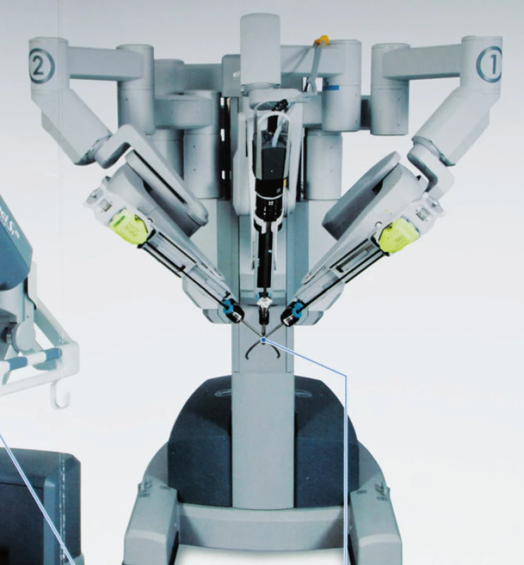 Robotické LEES instrumentárium u systému Da Vinci SI (2012)
Fig. 2. Robotic LESS instrumetarium by system Da Vinci SI (2012)