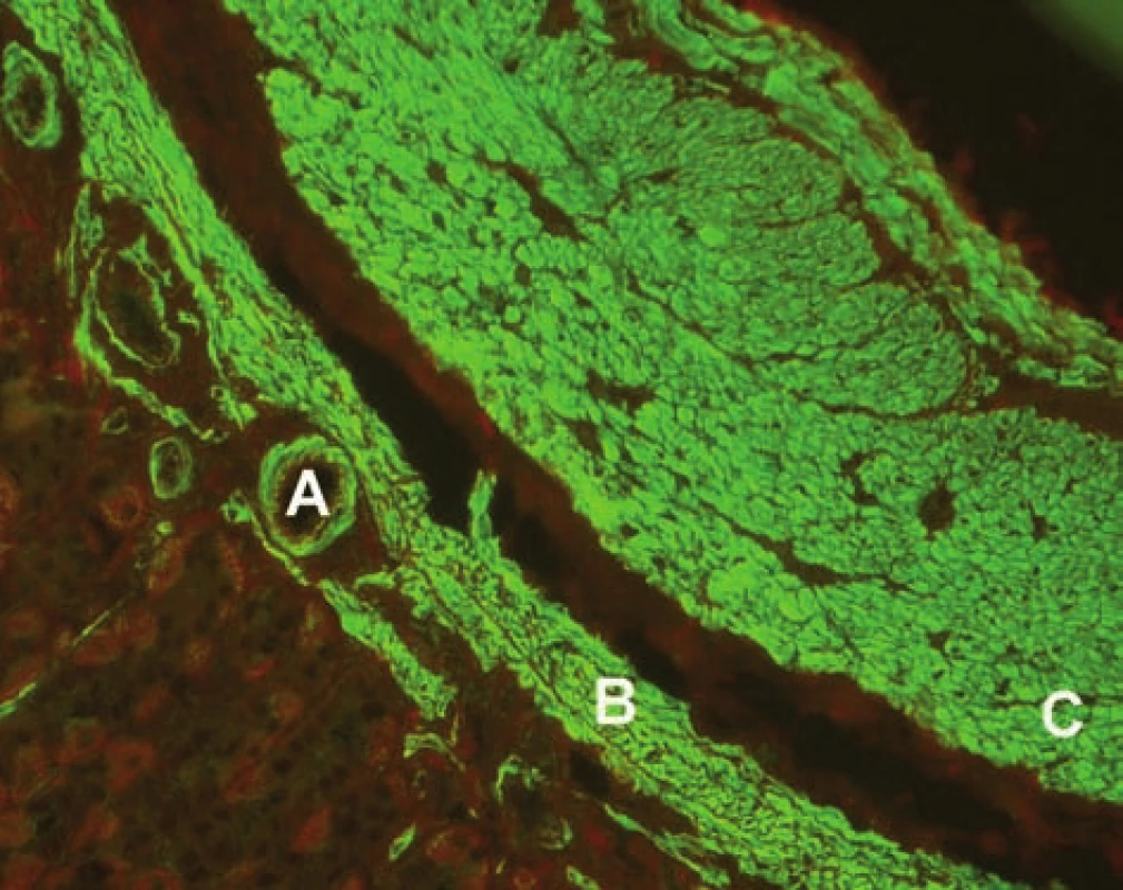Imunofluorescenční obraz protilátek proti hladkému svalu (substrát – krysí žaludek, A – hladký sval ve stěně cév, B – muscularis musosae, C – muscularis propria).
Fig. 1. Immunofluorescent image of smoothmuscle antibodies (substrate – rat stomach, A – smooth muscle in the vascular wall, B – muscularis musosae, C – muscularis propria).